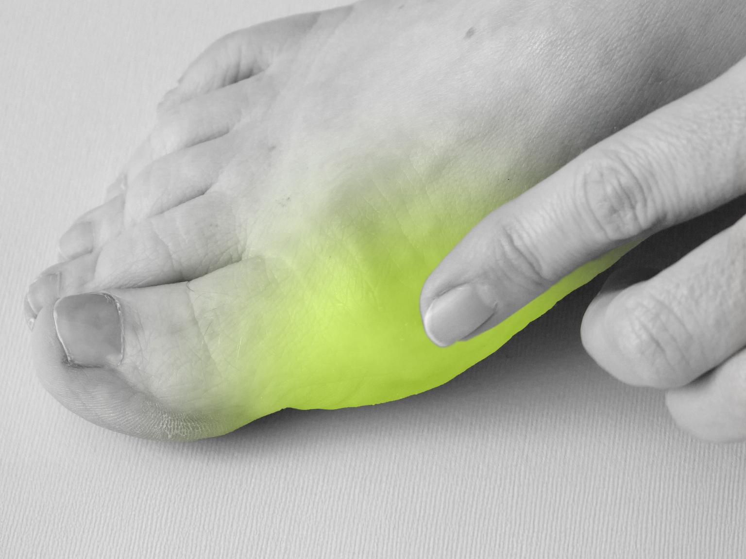 Bild von Das hilft gegen einen Hallux valgus