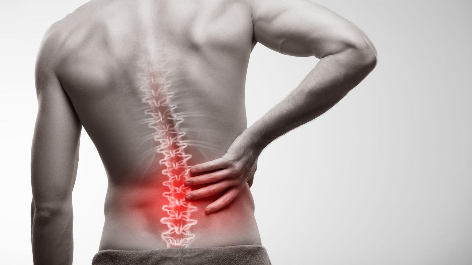 Image of What to Do Against Back Pain