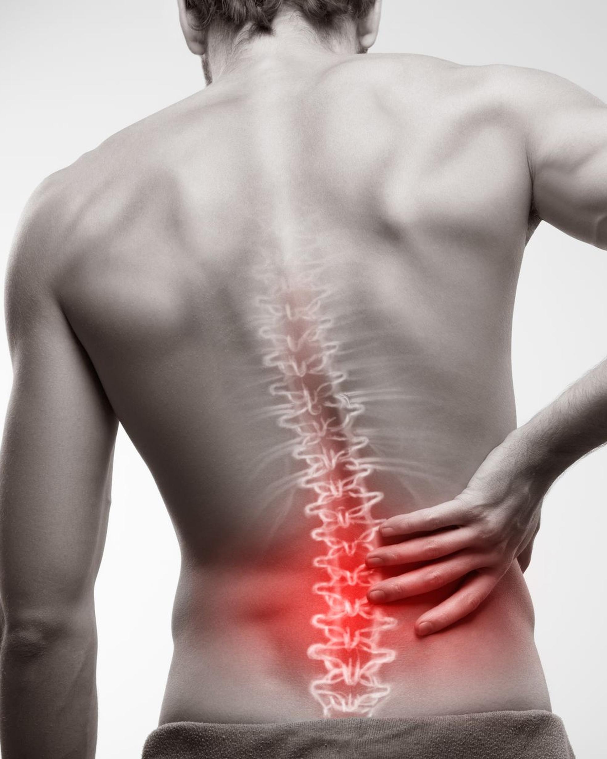 Bild von Was tun gegen Rückenschmerzen