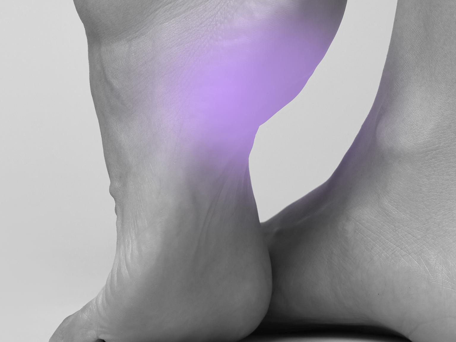Bild von Einlagen für Fersensporn (Plantarfasziitis)