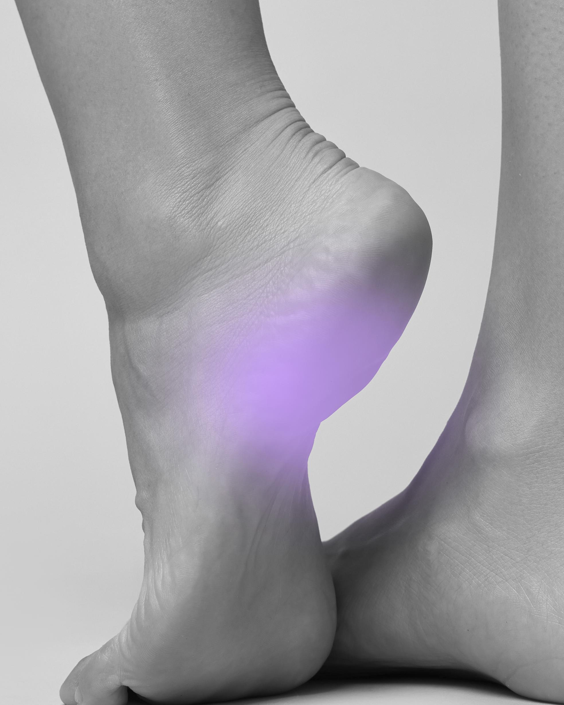 Bild von Einlagen für Fersensporn (Plantarfasziitis)