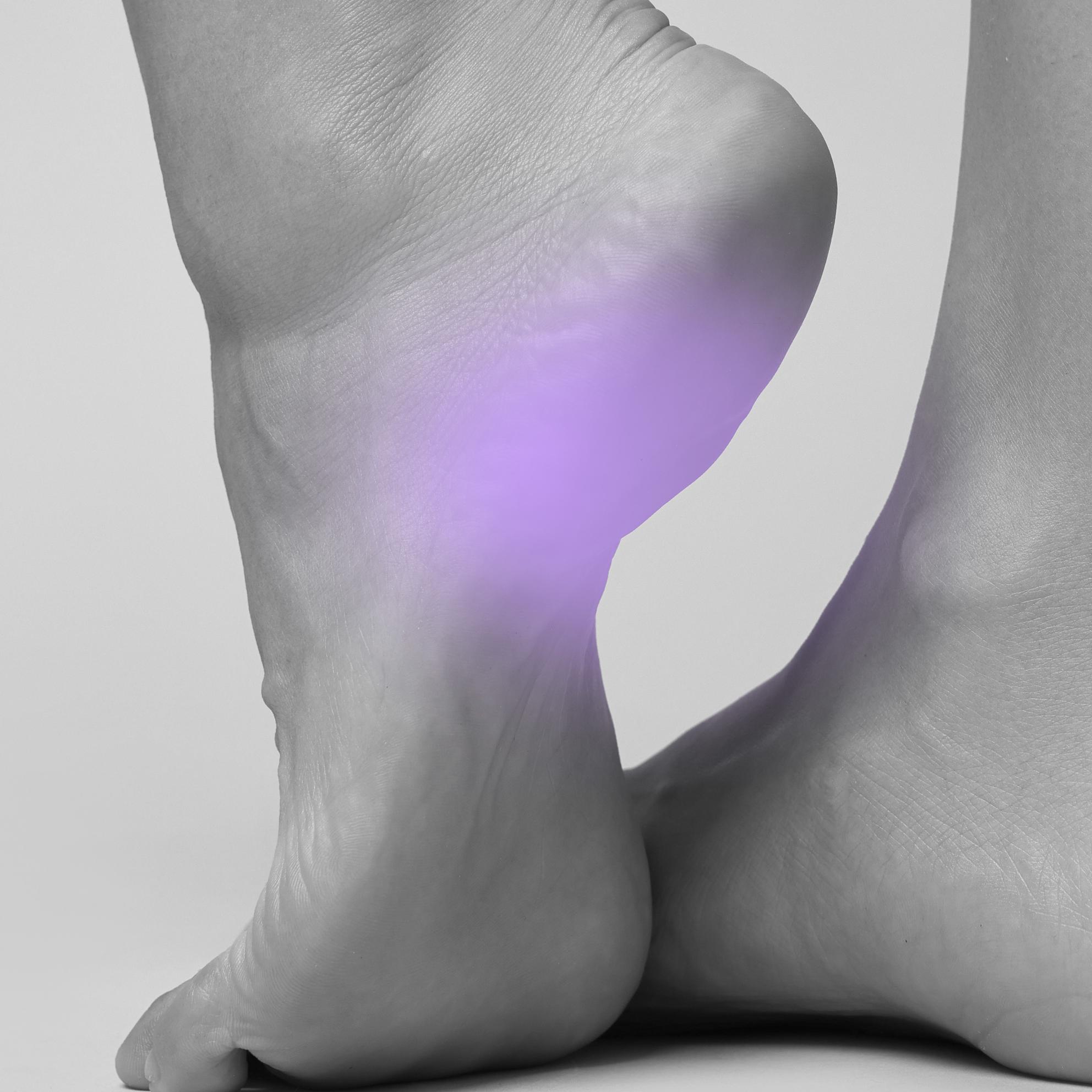 Bild von Einlagen für Fersensporn (Plantarfasziitis)
